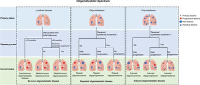 Combining stereotactic body radiotherapy with immunotherapy in stage IV non-small cell lung cancer